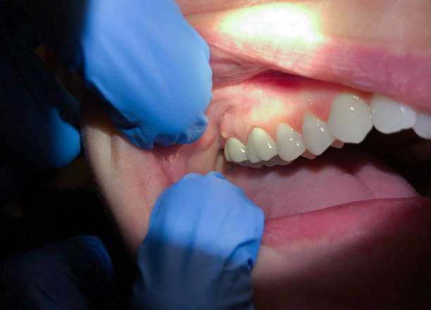 Best Broken Tooth Emergency  in Morris, OK