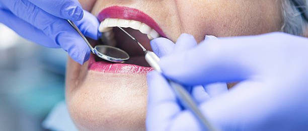 Best Teeth Whitening  in Morris, OK